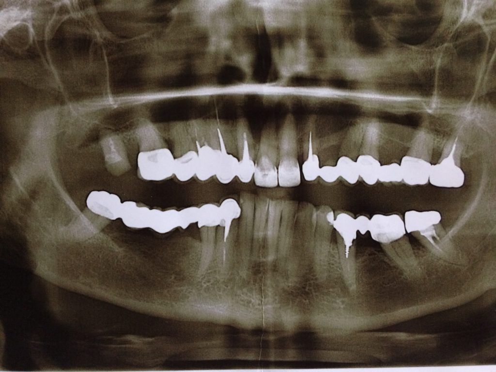 x-ray sample