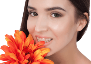 Cheap price of braces for teeth in Ukraine - Overseas Medical photo